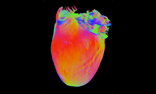 Image of heart illustrating its microstructure.