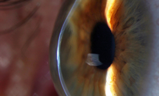 Close-up of the human eye